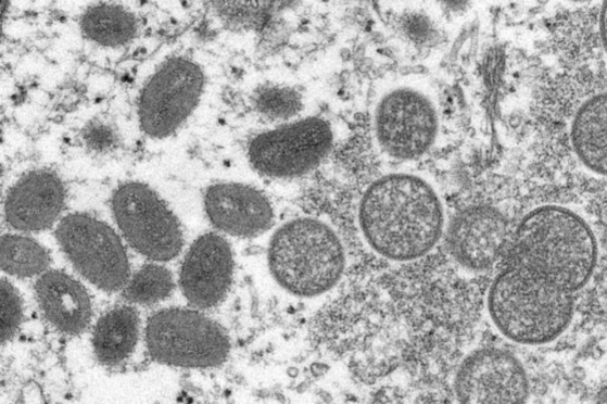 원숭이두창 바이러스를 현미경으로 확대한 모습. AP=연합뉴스