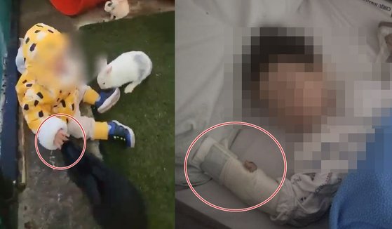 15개월 아이가 동물원 토끼에게 물려 손이 잘리는 부상을 당했는데도 동물원 측으로부터 제대로 된 사과와 보상을 받지 못했다는 사연이 전해졌다. 온라인커뮤니티 캡처