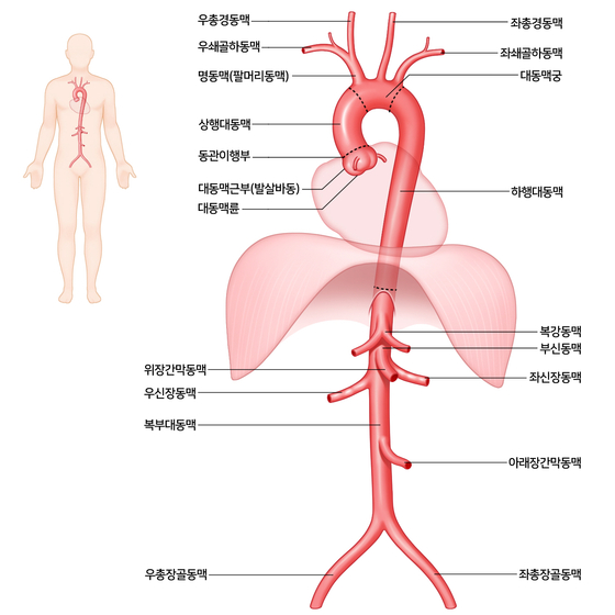 대동맥. 서울아산병원