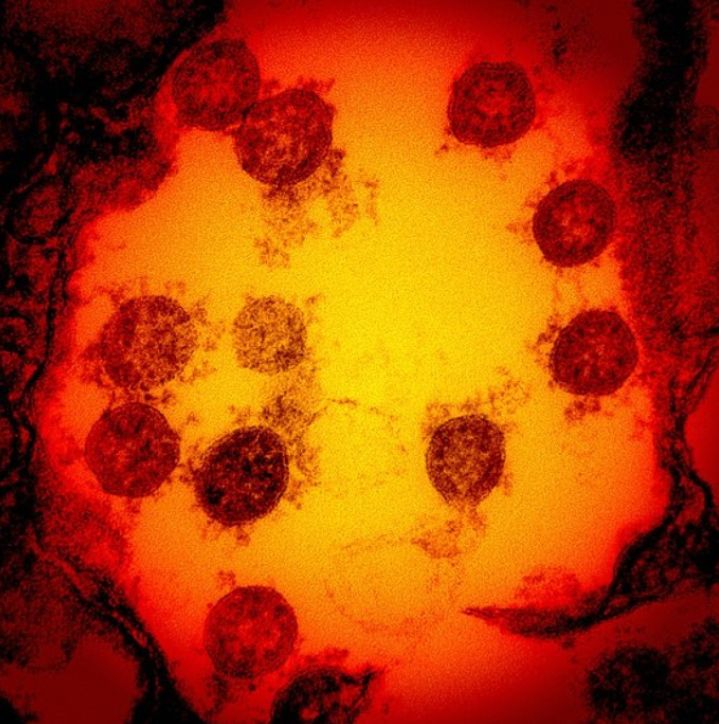 2020년 7월 미국에서 발견된 코로나19 바이러스 입자. [AFP=연합뉴스]