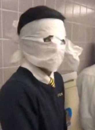 피해 학생의 머리에 휴지가 감겨있다. 사진 채널2액션뉴스